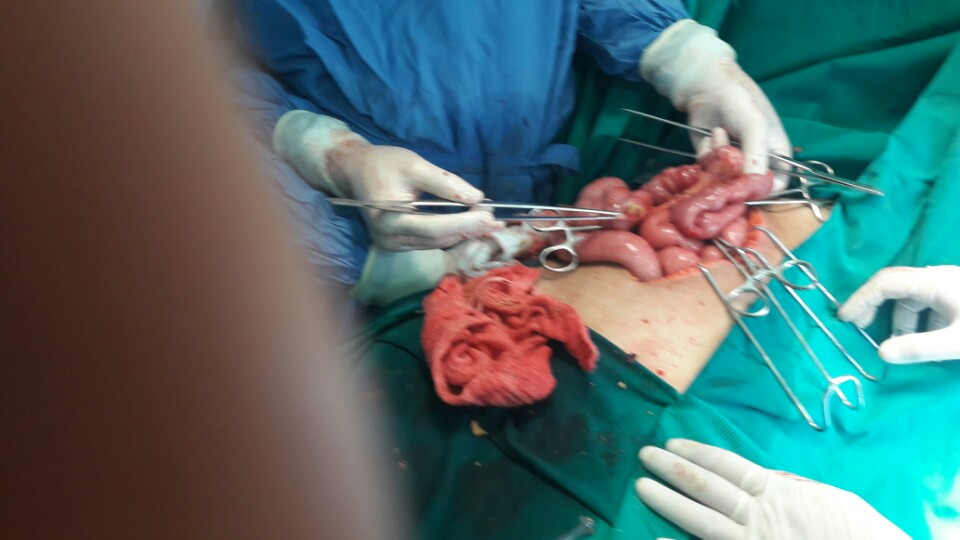 Vết thương thủng ở da - Hình ảnh minh họa